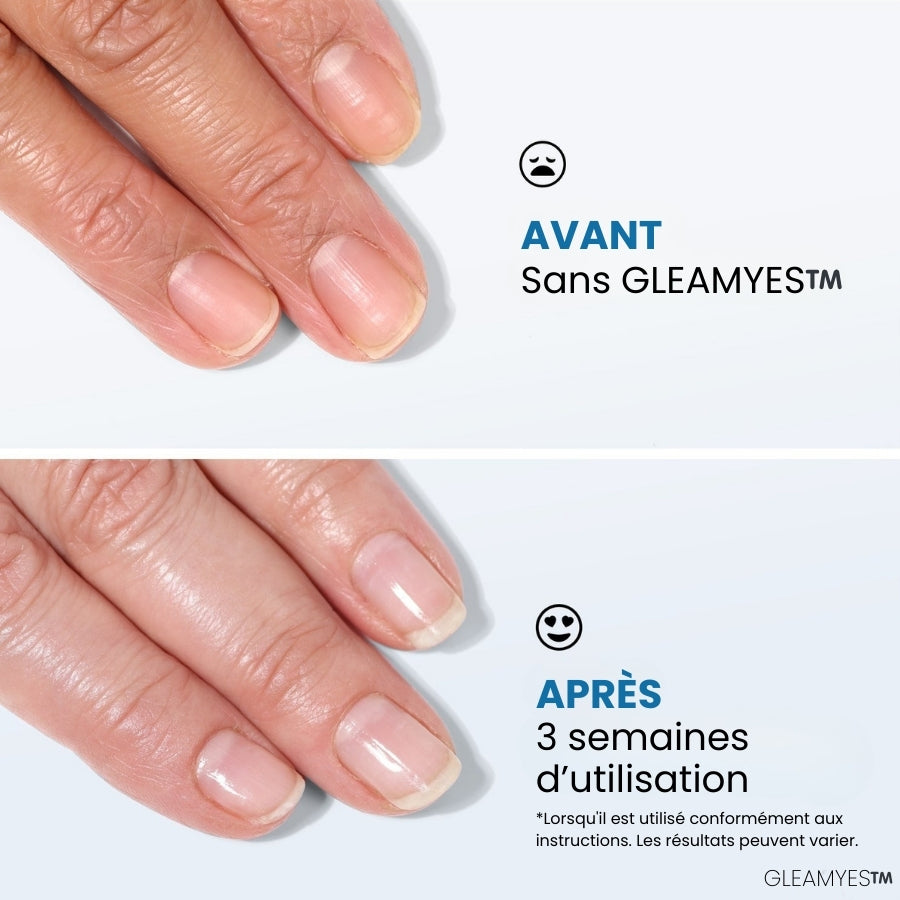 GLEAMYES™️ - Durcisseur Ongles 2-en-1 Fortifiant & Protecteur
